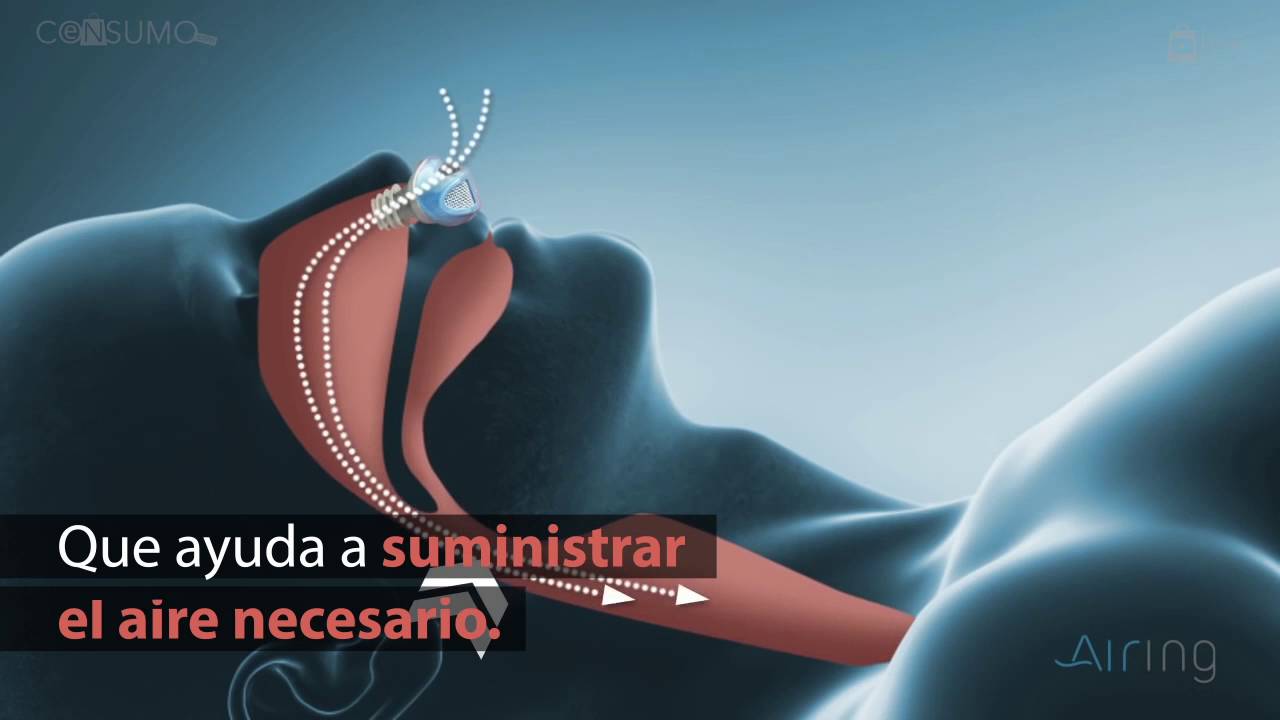 Aparatos Para No Roncar