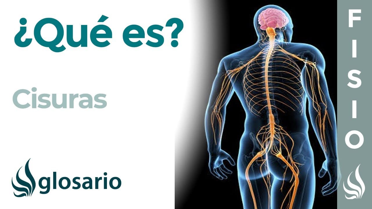 Cisuras Del Cerebro