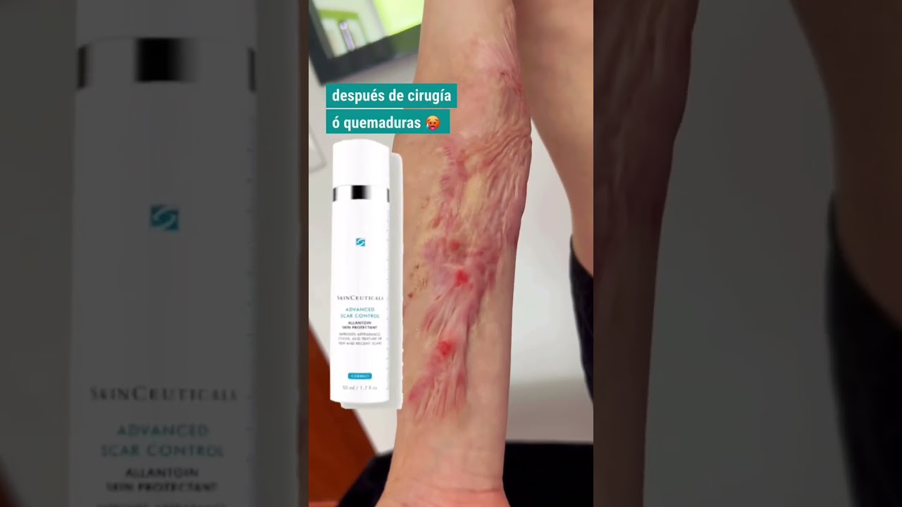 Crema Para Cicatrices De Cirugía