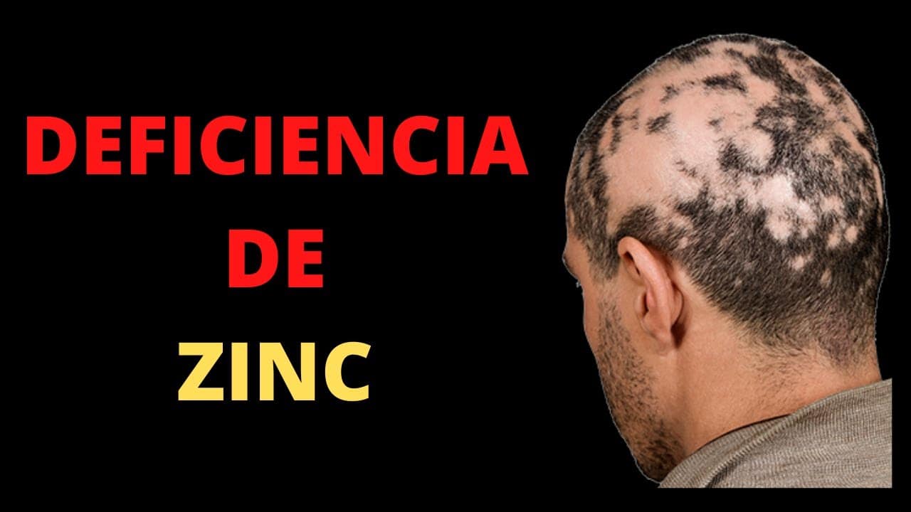 Deficiencia De Zinc