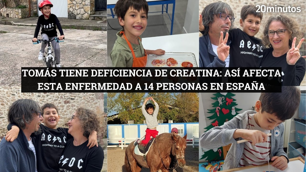 Deficiencia Del Transportador De Creatina
