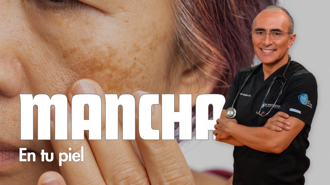 Eliminar Manchas De La Cara