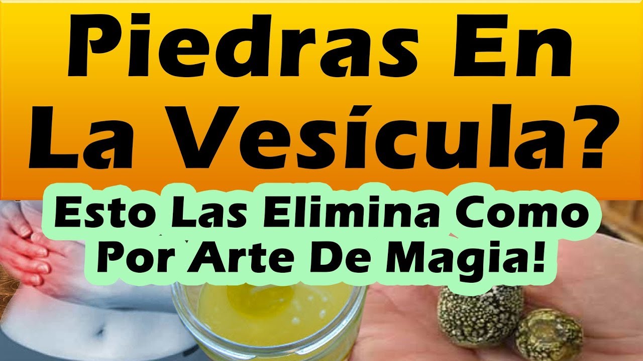 Eliminar Piedras Vesícula Sin Cirugía