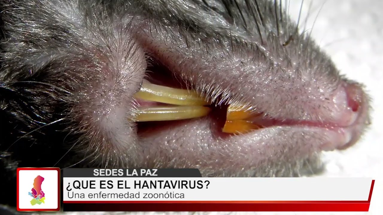 Hantavirus Que Es