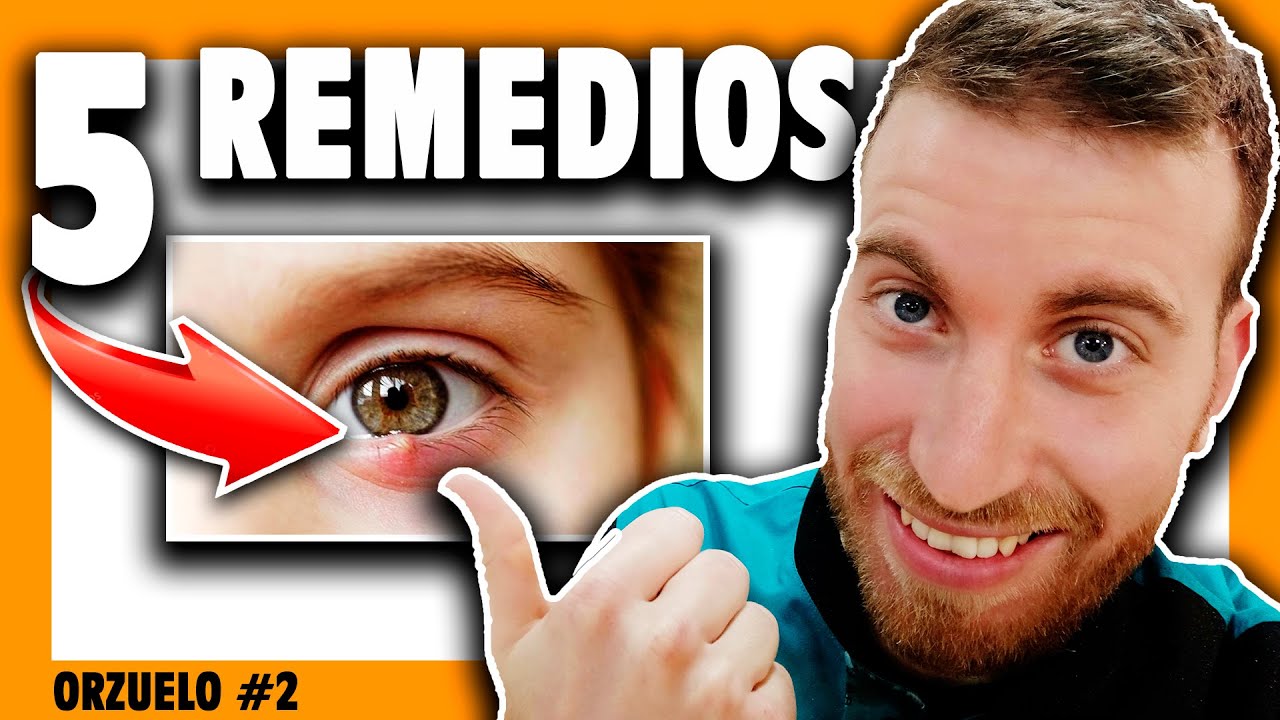 Que Es Un Orzuelo Y Como Se Cura