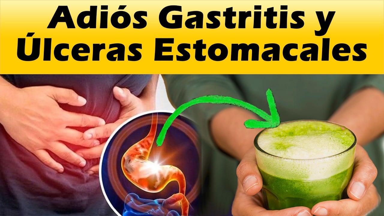Remedios Caseros Para La Gastritis
