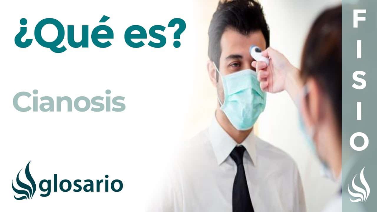 Cianosis