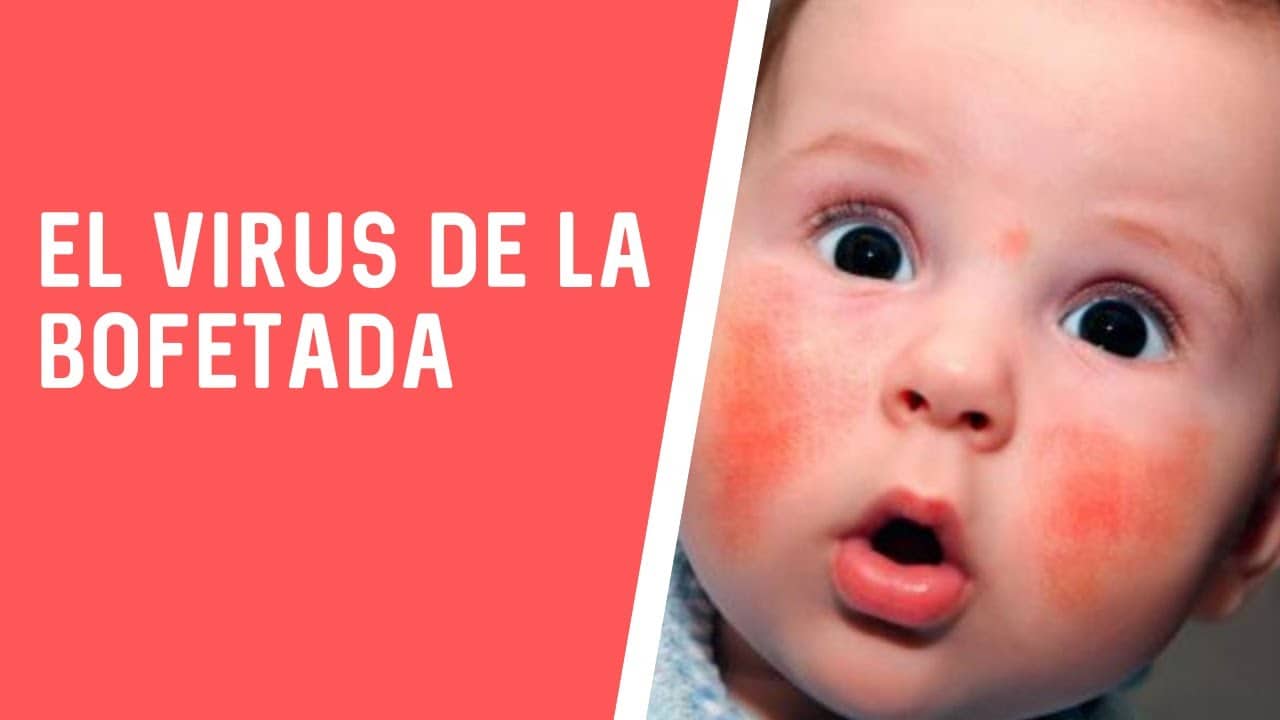 Virus Del Bofeton