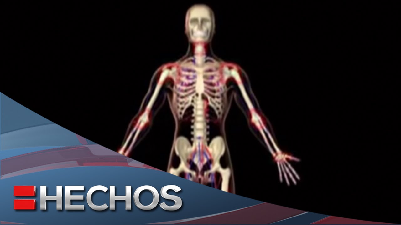 Artritis reumatoide cura definitiva