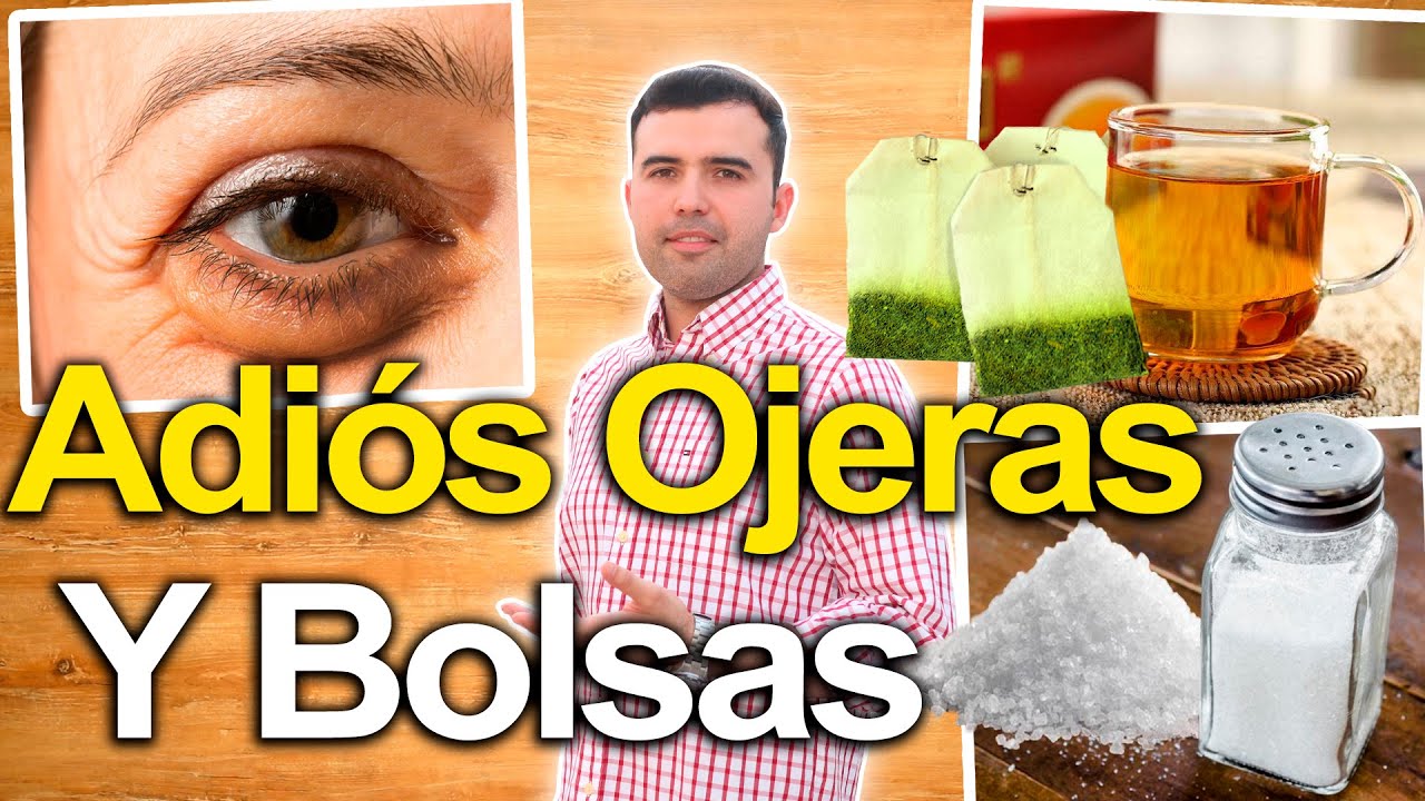 Bolsas en los ojos remedios