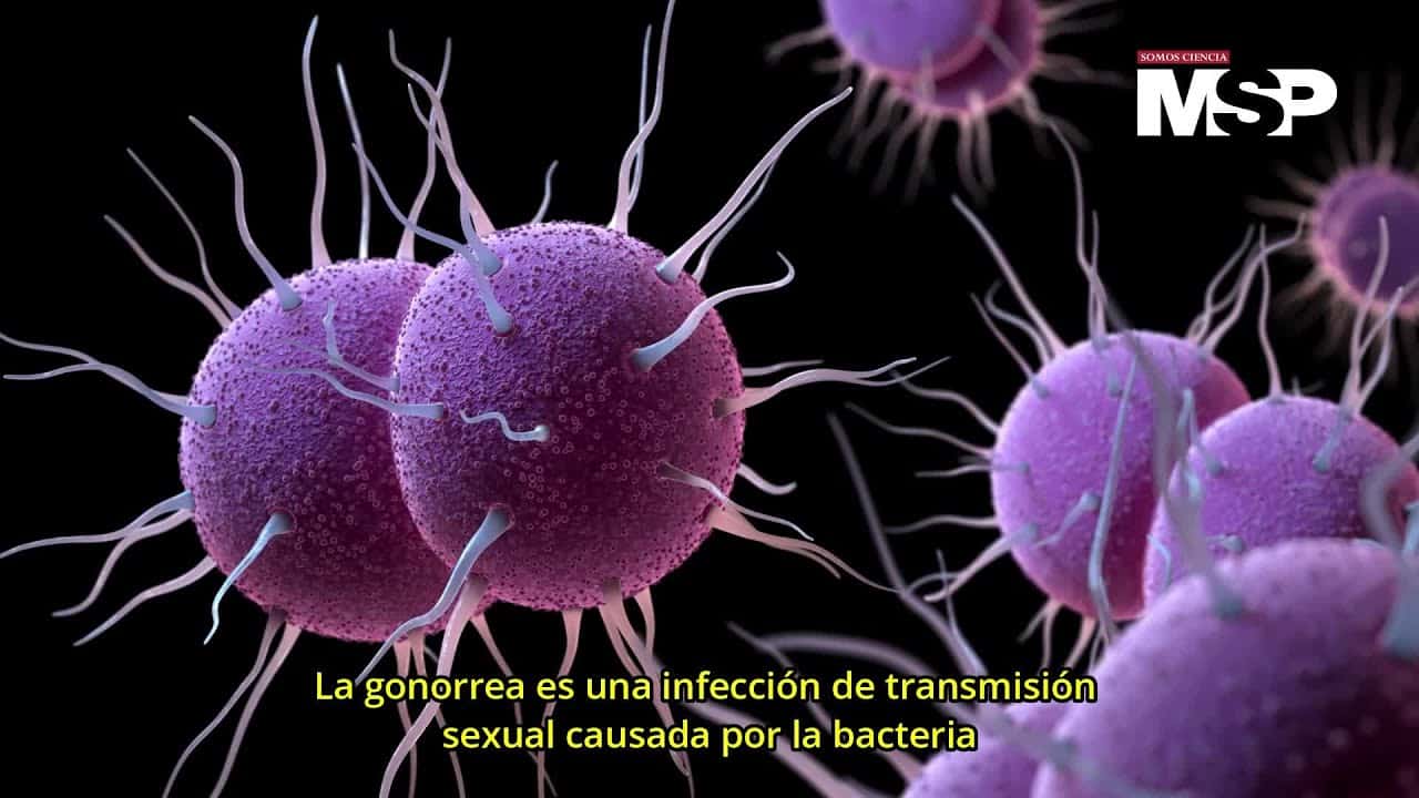 La gonorrea tiene cura