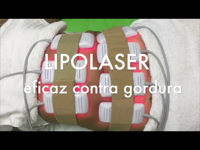 Lipolaser