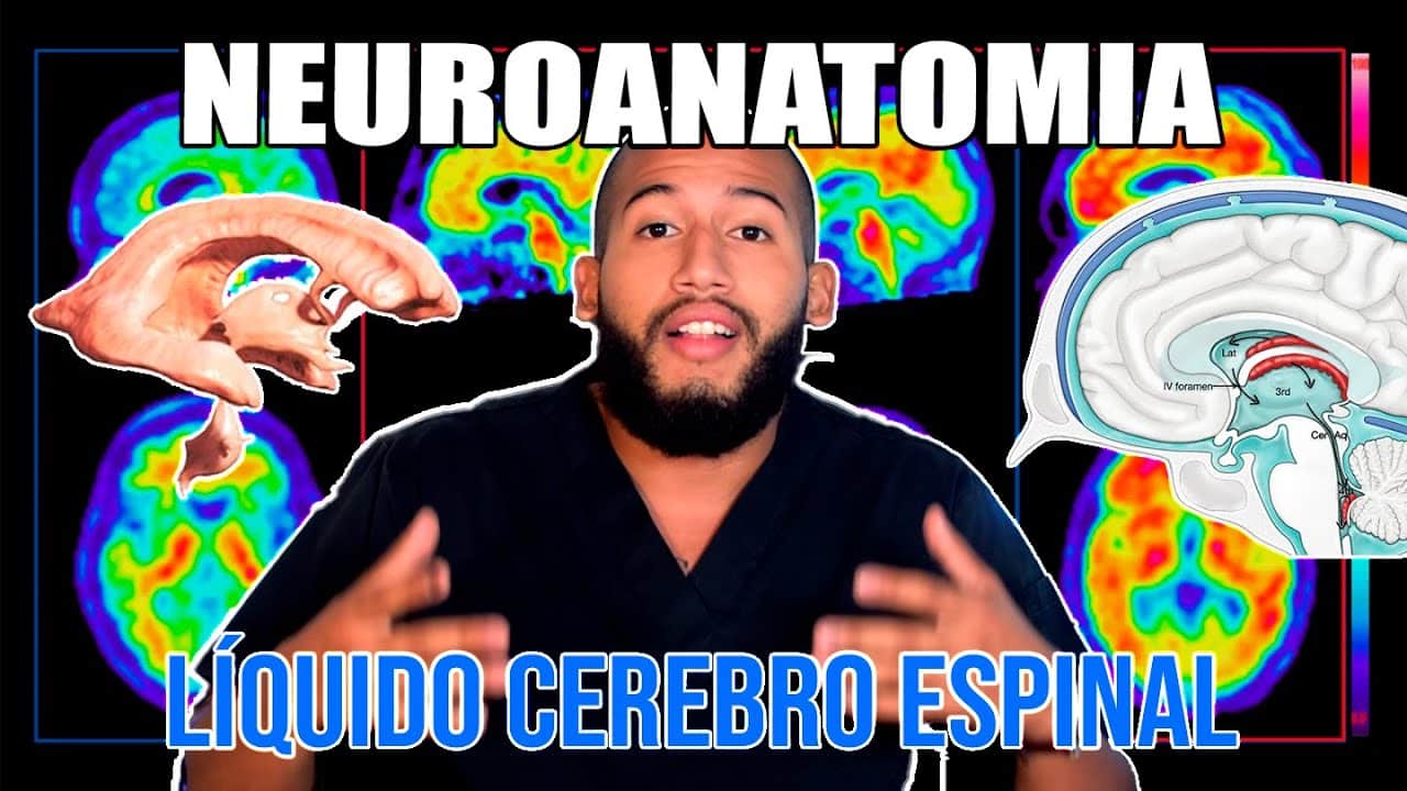 Plexo coroideo