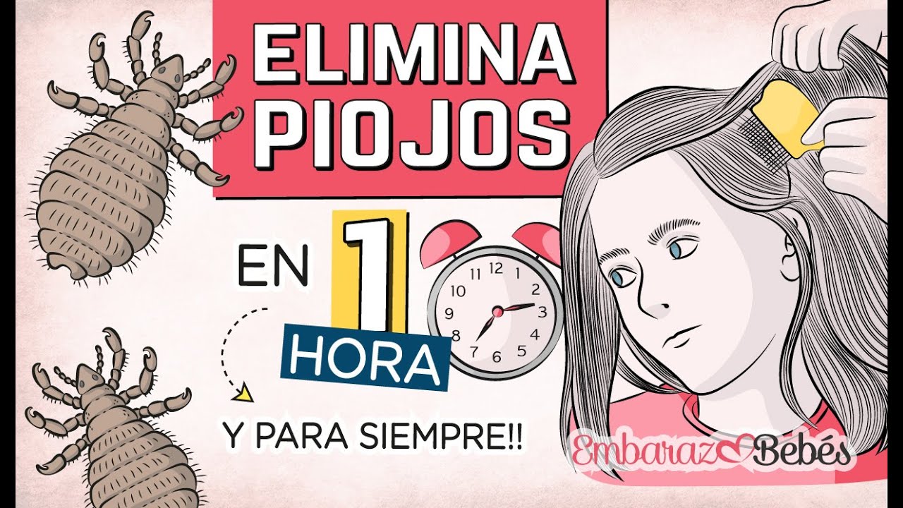 Remedios caseros piojos