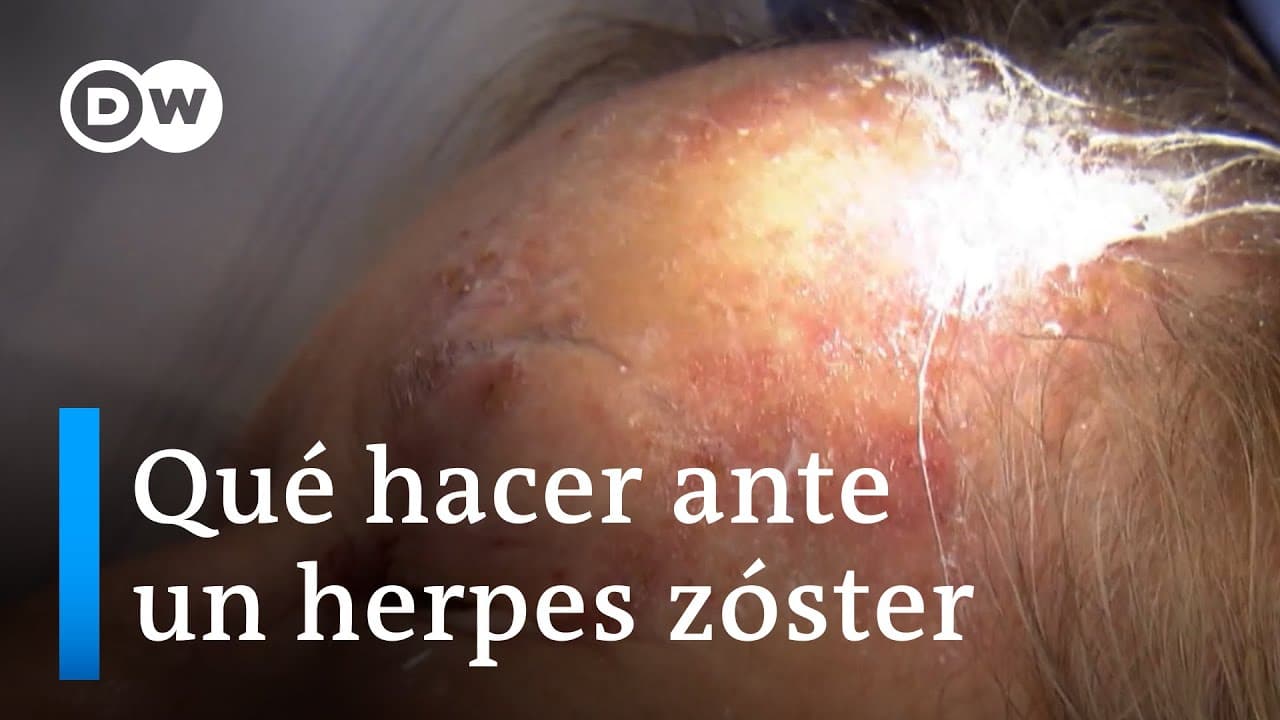 Vacuna herpes zoster nombre comercial