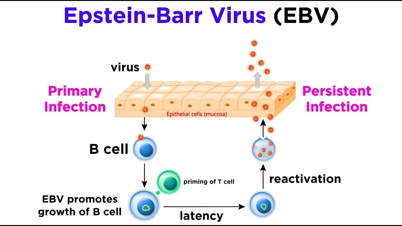 Virus epstein barr