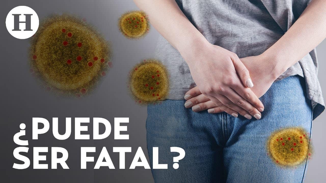 Virus estomacal síntomas
