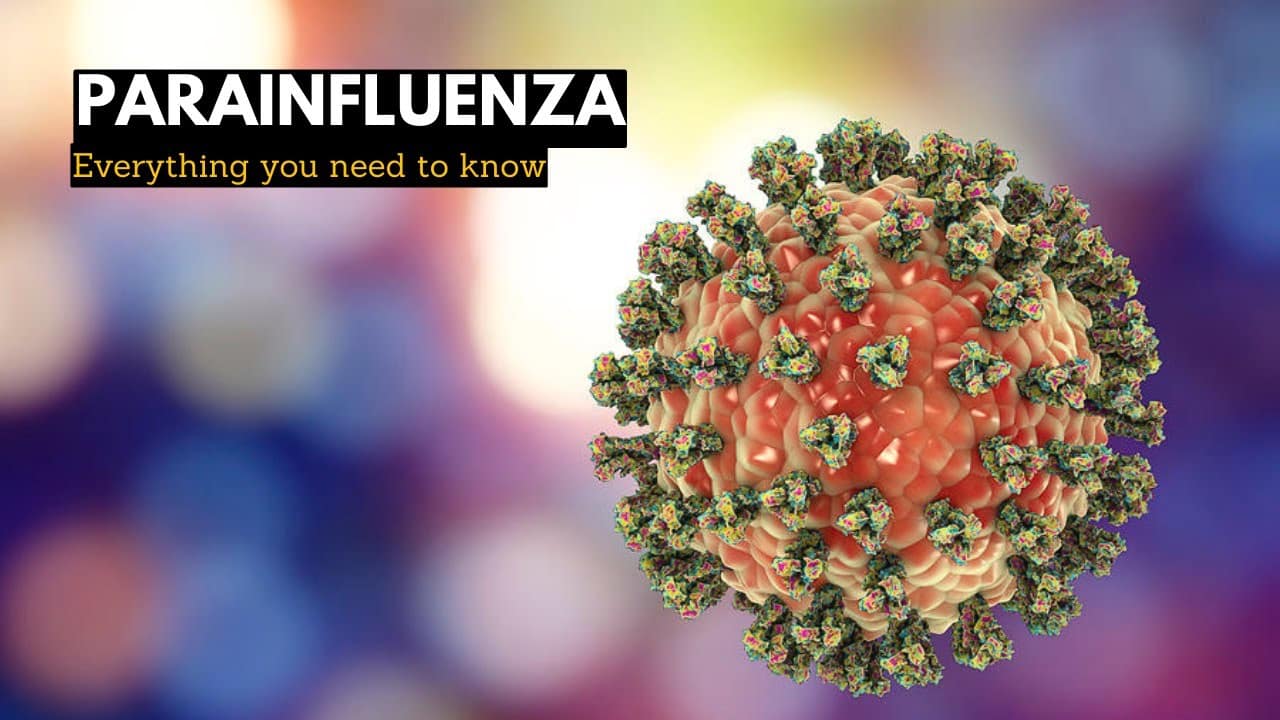 Virus parainfluenza