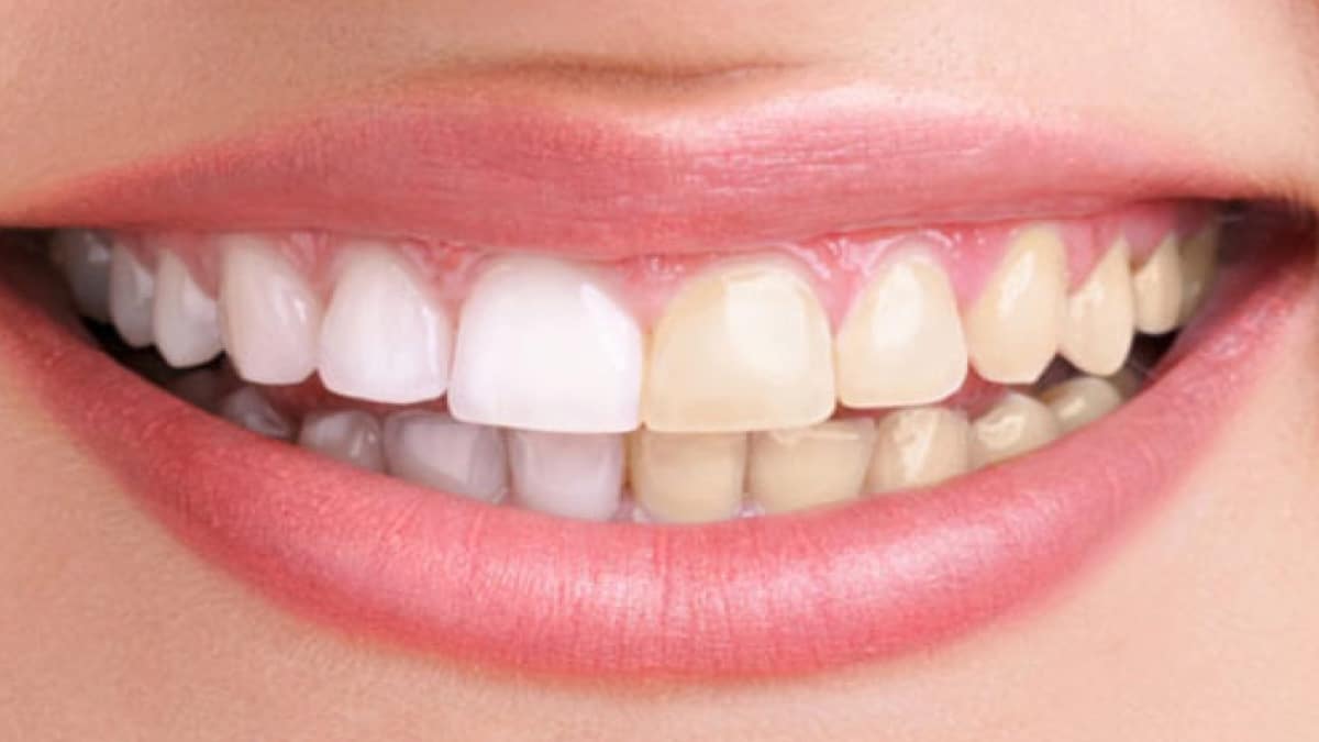 Un dentiste explique l'erreur la plus courante que nous faisons lorsque nous nous brossons les dents et qui pourrait les faire jaunir : « Ce petit pas... »